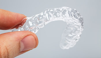 Smile Makeover Procedures