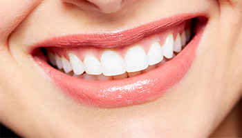 Smile Makeover Procedures